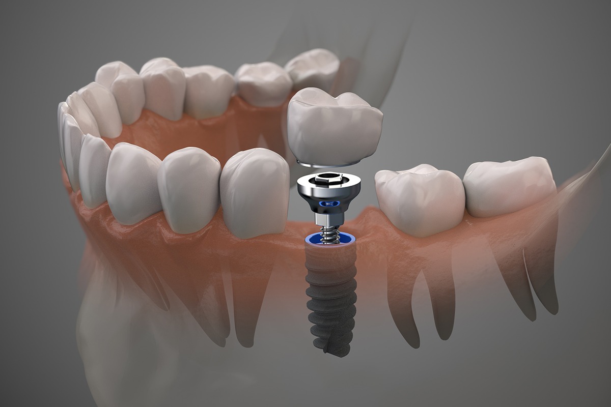 Dentist